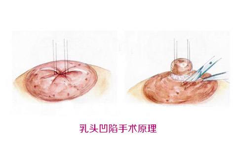 沈陽百嘉麗醫(yī)院之汪曉蕾：她的醫(yī)療造詣如何？
