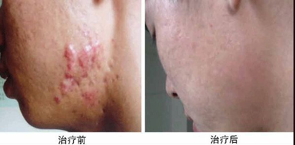 合肥哪家整容醫(yī)院雙眼皮做得好？專業(yè)整形外科專家推薦