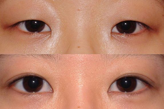 蘇州打瘦臉針哪家醫(yī)院好？2023年蘇州瘦臉針治療排行榜發(fā)布