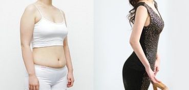成都做雙眼皮，哪家醫(yī)院專業(yè)可靠？