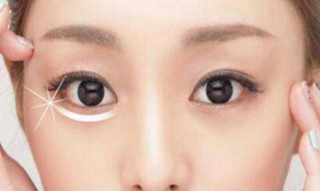荊州割眼袋哪家醫(yī)院好？眼袋修復(fù)專家為您推薦！