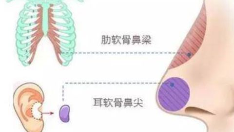 廣州有哪些醫(yī)院可以進(jìn)行抽脂手術(shù)？