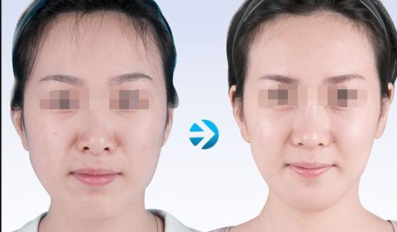 【2023北京哪家醫(yī)院做皮秒好？皮秒技術(shù)排行榜推薦】