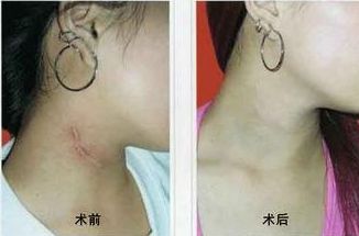南寧哪家醫(yī)院治痘效果好？選擇明星們的美肌秘密推薦的南寧優(yōu)質(zhì)醫(yī)院