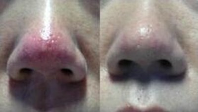 福州哪家醫(yī)生做隆胸技術(shù)好？推薦五位專業(yè)醫(yī)師，價格參考！