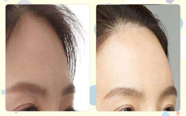 全國整容醫(yī)生PHD公開名單，創(chuàng)新技術行業(yè)新標桿