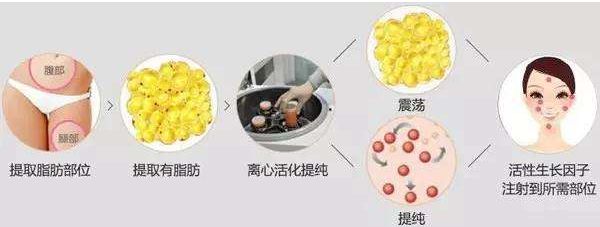 哈爾濱哪家醫(yī)院的去皺針效果好？