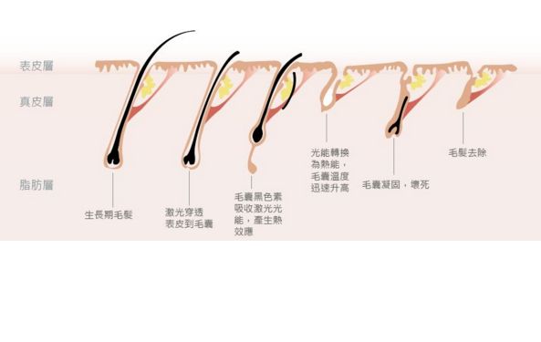 深圳哪家激光祛斑醫(yī)院口碑好？