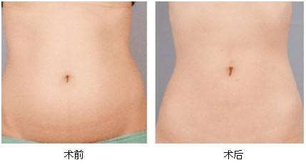 2023湘潭彩光美白嫩膚專家前10位排行榜(劉佑文、熊宜文、熊志能幫你圓夢)