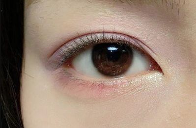 王世虎拉皮和脂肪填充的效果如何？有哪些多樣化的項目值得選擇？技術(shù)是否可靠可證？