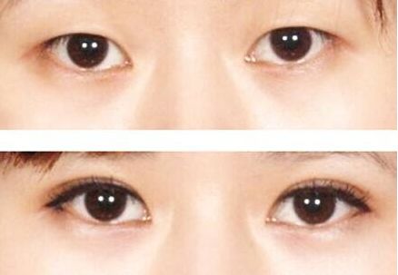 榆林市美容哪家醫(yī)院好？榆林市頂級美容醫(yī)院推薦