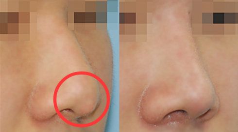 福州哪家醫(yī)院做疤痕好？比較全面的福州疤痕治療醫(yī)院推薦給您！