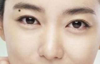 認識眼部大咖，探索秦宏偉醫(yī)生的簡介及雙眼皮案例分享