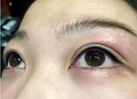 杭州藝星美容醫(yī)院：徐利剛所完成的鼻部整形效果如何？進(jìn)行人物簡(jiǎn)介以及鼻部整形手術(shù)風(fēng)格的介紹。
