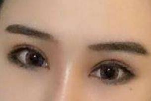 貴陽(yáng)梁安裕醫(yī)生技術(shù)在線解析腹壁成型效果，怎么樣？
