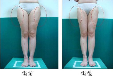 昆明哪家治痘痘好的醫(yī)院，痘痘問題如何有效解決？
