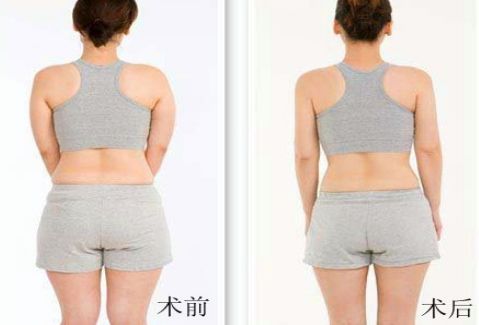 洛陽雙眼皮好的醫(yī)院有哪些？