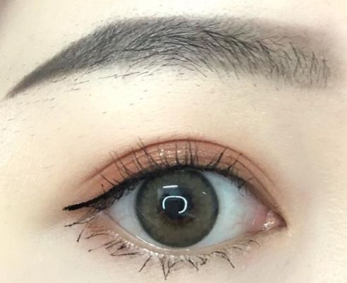 成都哪家美容醫(yī)院的埋線減肥效果好？
