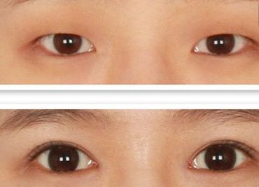 鄭州哪家美容醫(yī)院正規(guī)且口碑好？