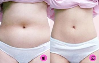 【2023吉林雙眼皮手術(shù)評(píng)測(cè)】哪家醫(yī)院值得信賴(lài)？