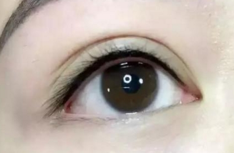 馬桂娥面頰填充脂肪能打造自然輪廓，挺陽高效！醫(yī)生背景介紹必讀！