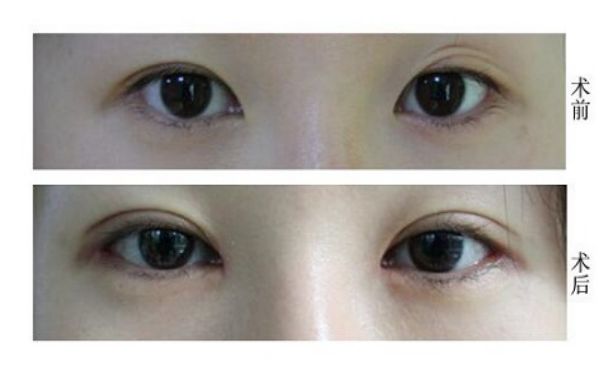 天津修復(fù)唇腭裂的醫(yī)院哪家好？專業(yè)解讀！
