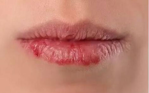 2023石家莊做眼袋手術(shù)評(píng)分十強(qiáng)醫(yī)生(王晶晶、種冬至、宋倩都是行業(yè)內(nèi)的佼佼者！)