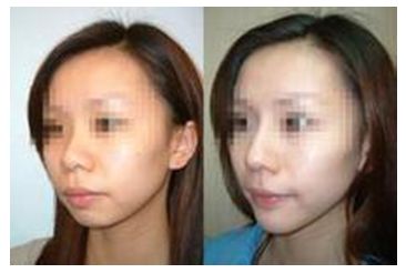 秦皇島美容美體哪家好？刷爆朋友圈的秘密美容院大揭秘！