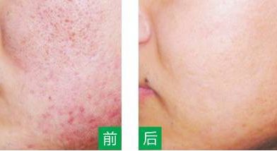 永州美辰醫(yī)療整形醫(yī)院的價(jià)格如何？收費(fèi)標(biāo)準(zhǔn)透明公開，術(shù)前注意事項(xiàng)必看！