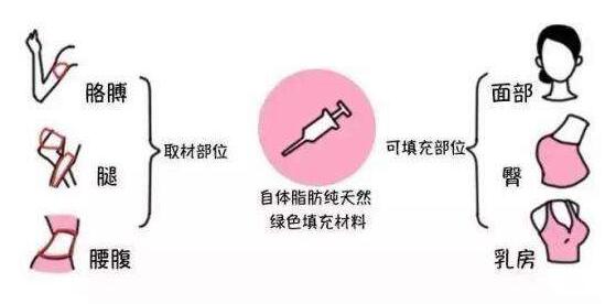 成都潘紅偉吸脂手術效果如何？專家解讀！