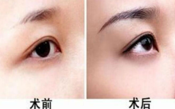 西京醫(yī)院超贊整形醫(yī)生與驚人隆鼻案例，受歡迎至極！