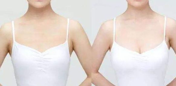 威海假體豐胸醫(yī)院哪家好？從專家口碑、手術(shù)效果看威海頂級醫(yī)院推薦！