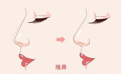 2023西安口周紋注射填充評分10強醫(yī)生(李朋娟、張筠莉、唐龍多院同臺競技爭高下)