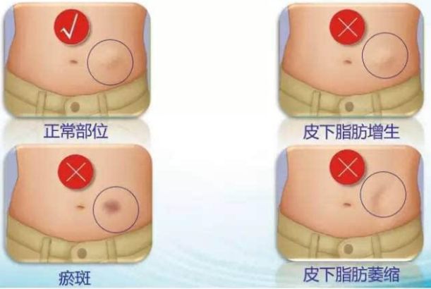 哈爾濱整形醫(yī)院哪家好？選擇哈爾濱整容醫(yī)院前必知的五大關(guān)鍵點(diǎn)