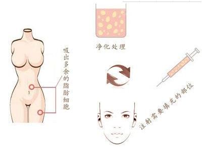 廣州燒傷疤痕治療哪家醫(yī)院效果好，選擇哪家醫(yī)院最靠譜？