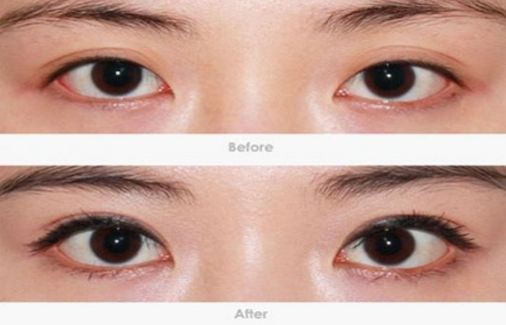 柳州哪家醫(yī)院做疤痕切除好？-獨家分享柳州疤痕切除醫(yī)院排行榜