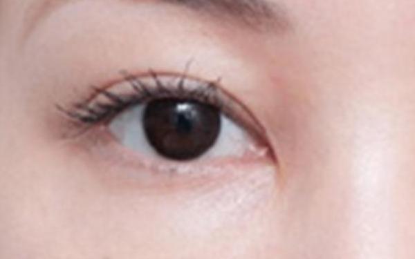 廣州哪家醫(yī)院做隆胸手術(shù)技術(shù)高？醫(yī)生資深經(jīng)驗來看詳細介紹！