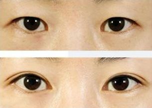 上海治療青春痘的專家推薦，哪家醫(yī)院效果最佳？