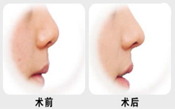 上海專業(yè)唇部整形五大口碑專家公布，人氣名醫(yī)張余光、周佳、戴傳昌等榜上有名