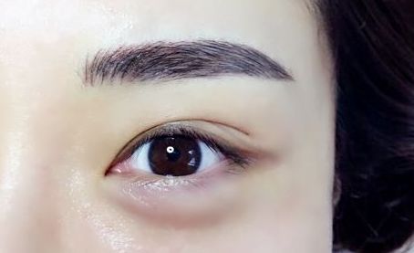 銀川有哪些專業(yè)的激光祛痘印醫(yī)院值得推薦？
