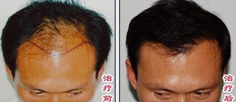 榆林醫(yī)專附屬醫(yī)院醫(yī)學(xué)整形美容中心怎么樣？榆林醫(yī)專附屬醫(yī)院醫(yī)學(xué)整形美容中心簡(jiǎn)介|醫(yī)生團(tuán)隊(duì)|口碑評(píng)價(jià)！