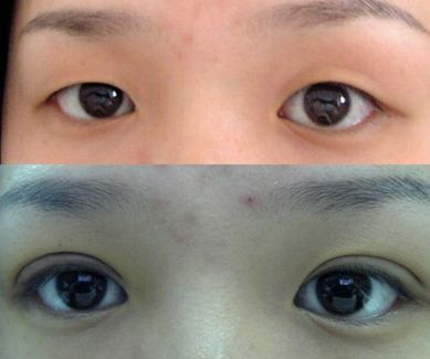 濟(jì)南哪家整形醫(yī)院的拉皮效果好且價(jià)格合適？