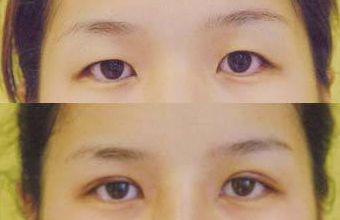 大慶微整形醫(yī)院哪家好？頂級(jí)專家為您解讀微整形醫(yī)院選擇指南！