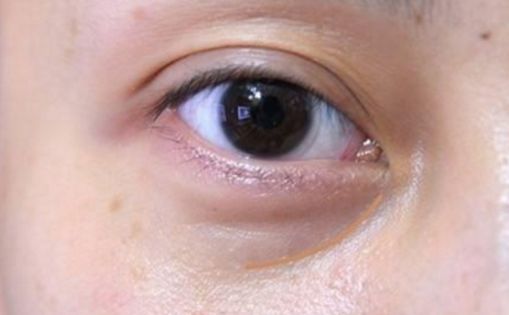 邯鄲哪家醫(yī)院做私密整形好？解析當(dāng)代女性美容訴求