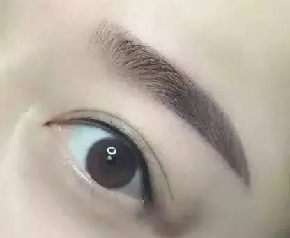 佰華利董萍的面部脂肪填充經驗，展現(xiàn)自然少女感