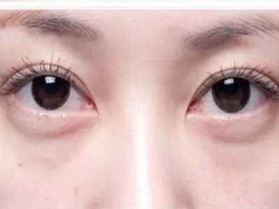 寧波祛斑哪家醫(yī)院好？精選寧波祛斑專業(yè)醫(yī)院推薦！