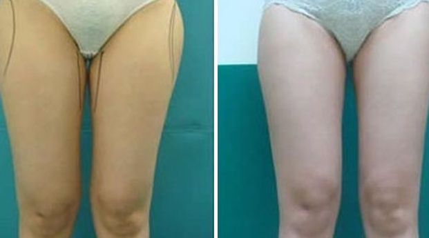 揭陽激光美容醫(yī)院哪家好？選擇揭陽最佳激光美容醫(yī)院的7個關鍵要素！