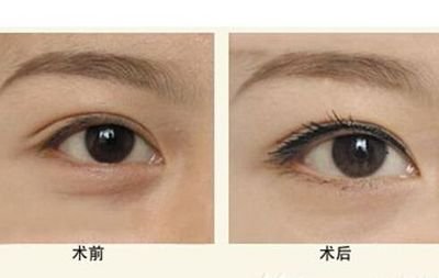 寧波隆鼻Top5醫(yī)生：技術(shù)精湛，聲譽(yù)卓越，口碑贊不絕口！