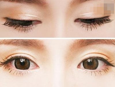 西寧豐胸整形醫(yī)院排名前三，專業(yè)醫(yī)生推薦！