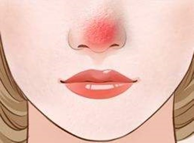 上海九院哪位醫(yī)生做雙眼皮技術(shù)好？?jī)r(jià)格如何？附帶成功案例分析